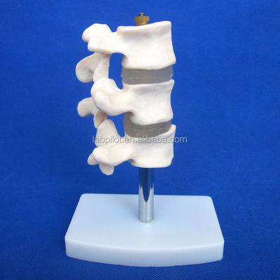 Modelos educacionais avançados de PVC Cutaway Osteoporose da coluna Lesões da vértebra lombar