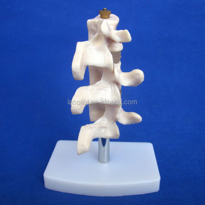 Modelos educacionais avançados de PVC Cutaway Osteoporose da coluna Lesões da vértebra lombar