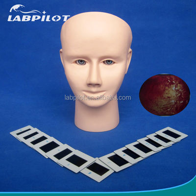 Manikin para o Exame Avançado do Olho Humano de Treinamento Simulador Retinopatia Fundus Modelo
