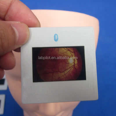 Manikin para o Exame Avançado do Olho Humano de Treinamento Simulador Retinopatia Fundus Modelo