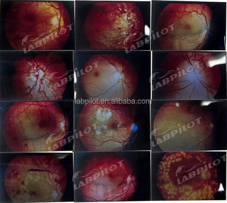 Manikin para o Exame Avançado do Olho Humano de Treinamento Simulador Retinopatia Fundus Modelo
