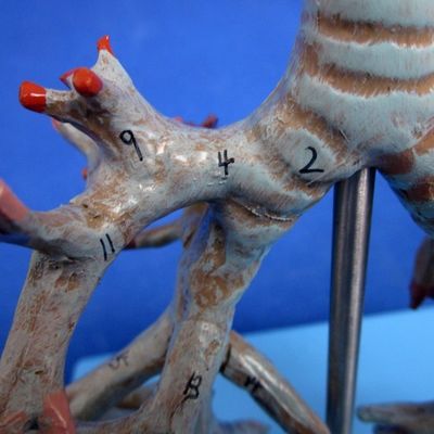 Árvore Bronquial Anatomical Viva Modelo 26 Posições Marcado Traqueia Anatomia para Ciência Médica