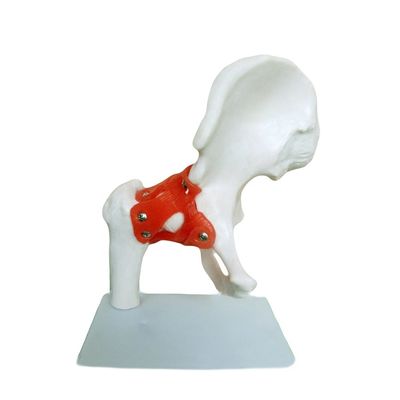Estruturas detalhadas de anatomia Ensino médico Modelo da articulação do quadril com ligamento artificial O osso humano