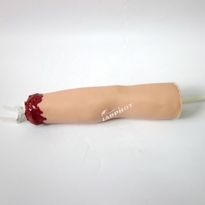 Modelo de cuidados de enfermagem de trauma Amputação do braço e hemostase para tratamento de feridas de membros superiores