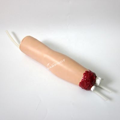 Modelo de cuidados de enfermagem de trauma Amputação do braço e hemostase para tratamento de feridas de membros superiores