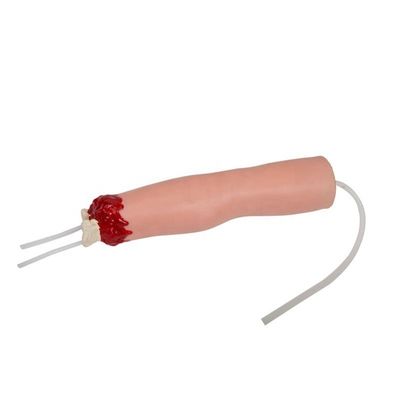 Modelo de cuidados de enfermagem de trauma Amputação do braço e hemostase para tratamento de feridas de membros superiores
