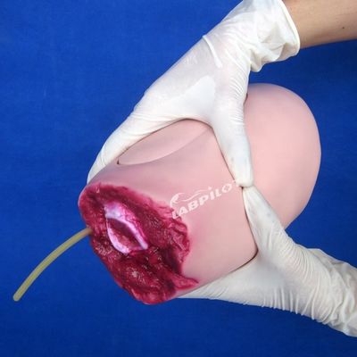 Modelo avançado de PVC A solução ideal para a enfermagem de amputação de coxas e membros inferiores