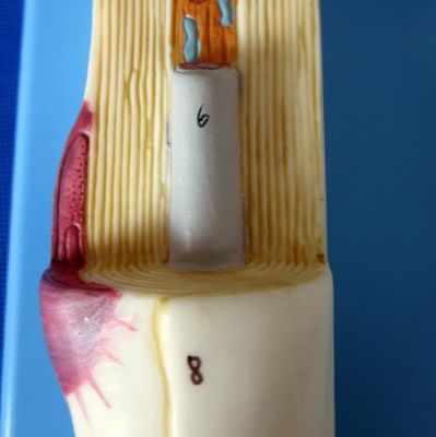 Modelo anatômico avançado de PVC do corpo neuronal aumentado e estrutura de fibras nervosas