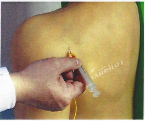 Treinamento Médico Avançado de PVC Modelo de Ensino de Injeção Intracavitária da Junta do Ombro