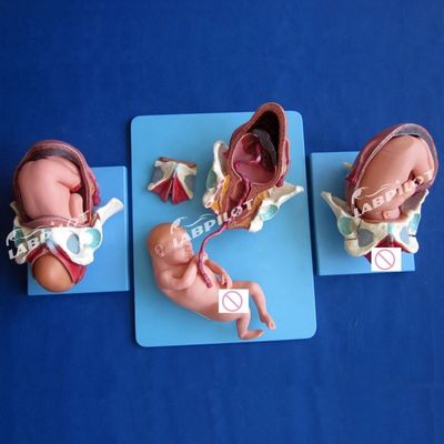Modelo de demonstração anatómica médica Pelvis e Feto a termo