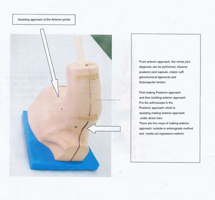 Modelo de treinamento de anatomia articulada do ombro com simulador de artroscopia do ombro desmontável