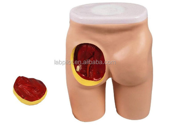 Modelo de Ensino Integral de Injeção IM para Educação em músculos glúteos e anatomia