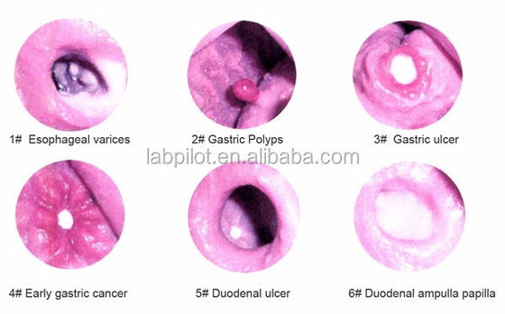 Exame Gastroscópico Avançado e Modelo de Treinamento ERCP para Lesões Gastrointestinais