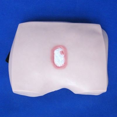 Decúbito Doença Modelos de Evolução para Hospitais Rationalização de Pressão Úlceras Enfermagem