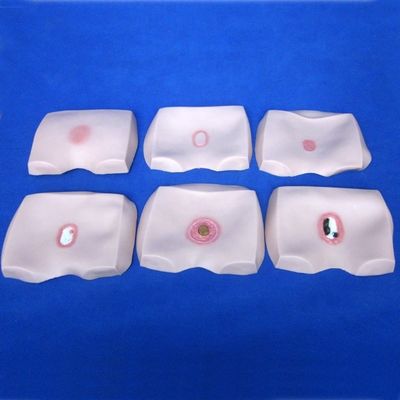 Modelos de formação em enfermagem clínica Etapas do decúbito úlcera Cuidados de enfermagem para hospitais