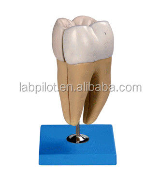 Estruturas anatômicas detalhadas dos dentes molares inferiores adultos Modelo avançado de cuidados dentários de PVC