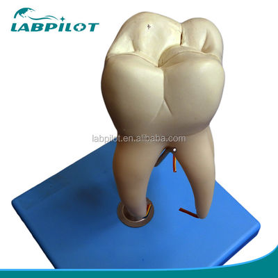Demonstração de cuidados dentários Modelo de dentes anatômicos desmontáveis para dentes molares de três raízes