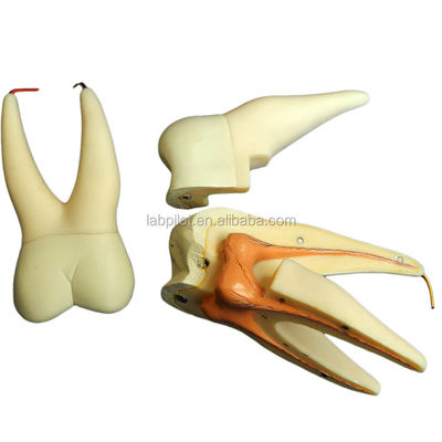 Demonstração de cuidados dentários Modelo de dentes anatômicos desmontáveis para dentes molares de três raízes