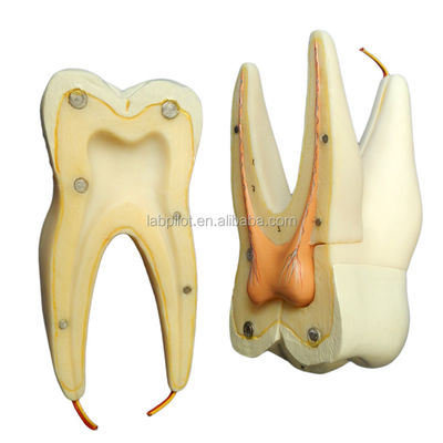 Demonstração de cuidados dentários Modelo de dentes anatômicos desmontáveis para dentes molares de três raízes