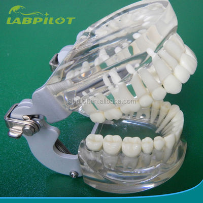 Modelos de formação em odontologia Padrão adulto transparente Padrão de coluna dentária Padrão de tamanho padrão
