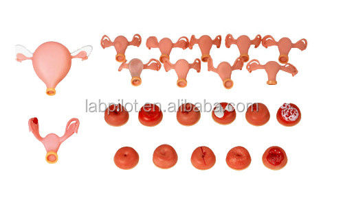 Manikin para ginecologista multifuncional Formação de enfermagem Modelo de exame vaginal