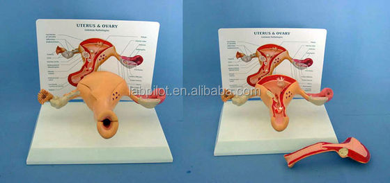 Modelo avançado do útero e do ovário humano em PVC para a educação do sistema reprodutivo feminino