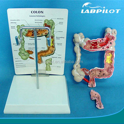 Modelos Oftalmológicos Modelos anatômicos Modelo do intestino humano para doenças do cólon e do reto