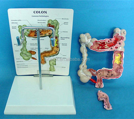 Modelos Oftalmológicos Modelos anatômicos Modelo do intestino humano para doenças do cólon e do reto