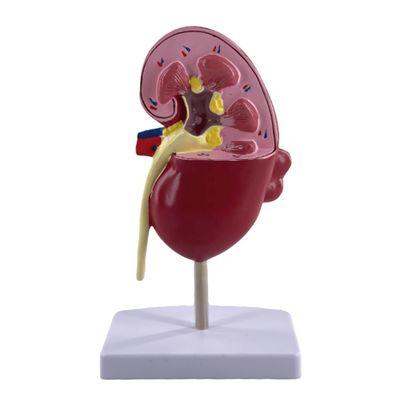 Modelo de rim patológico de PVC para escolas médicas e hospitais de urologia