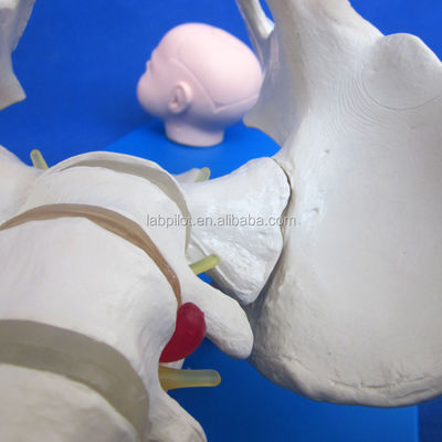 Pelvis e Cabeças Fetais Avançados Modelo de PVC para Demonstração de Habilidades de Parto
