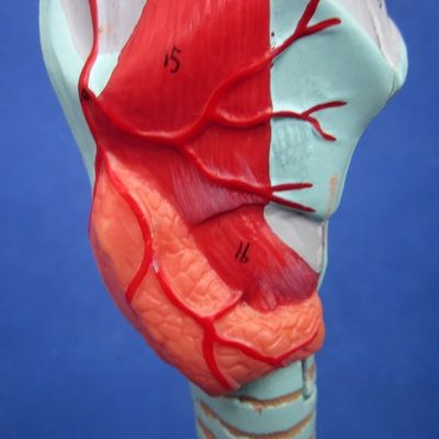 Ciência Médica Display Removível Árvore Bronquial e Traqueia Modelo para a anatomia da laringe