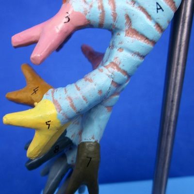 Ciência Médica Display Removível Árvore Bronquial e Traqueia Modelo para a anatomia da laringe