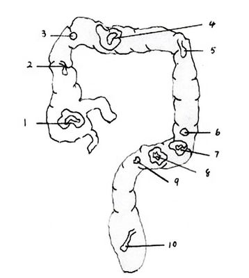 Modelo de anatomia do reto e do cólon PVC avançado Simulador de endoscopia intestinal de tamanho humano