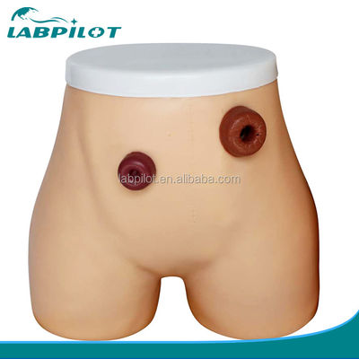 Modelo avançado de enfermagem de ostomia de PVC para formação em ileostomia e colostomia em hospitais