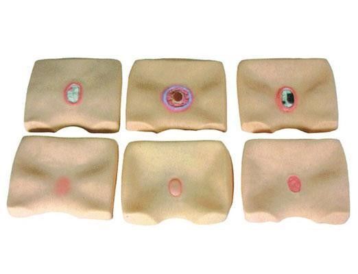 Simulador de úlceras de decúbito da pele das nádegas para hospitais Melhorar a formação em enfermagem de úlceras de cama