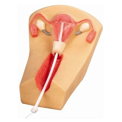 O IUD de PVC é a ferramenta ideal para ensinar sobre planejamento familiar