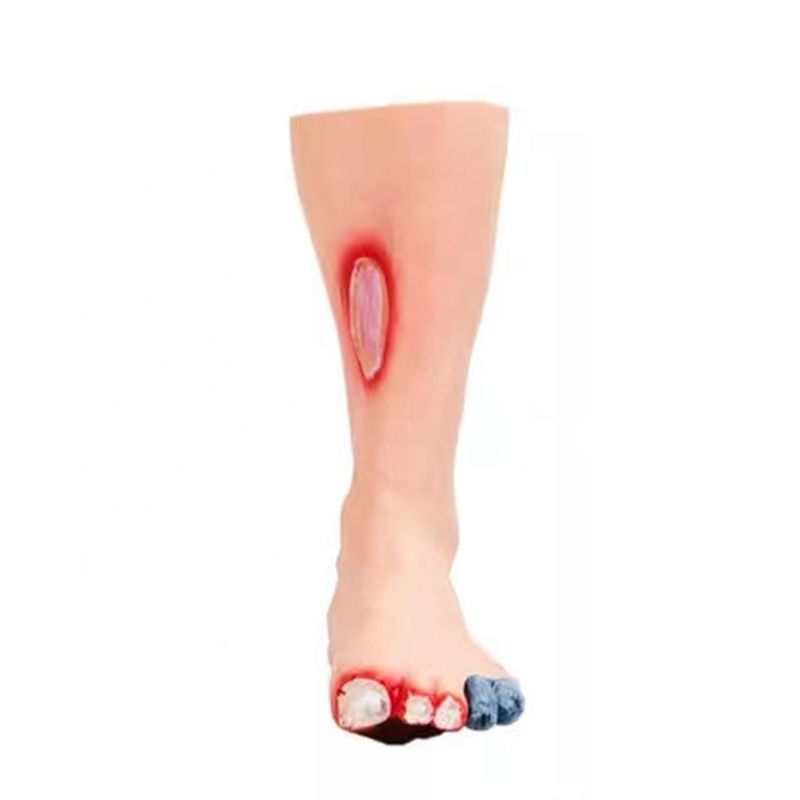 Modelo de Pés de Tamanho Humano A ferramenta essencial para profissionais de cuidados com os pés diabéticos