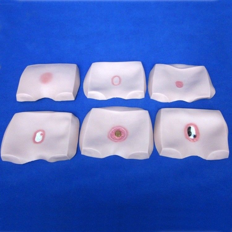 Modelos de formação em enfermagem clínica Etapas do decúbito úlcera Cuidados de enfermagem para hospitais