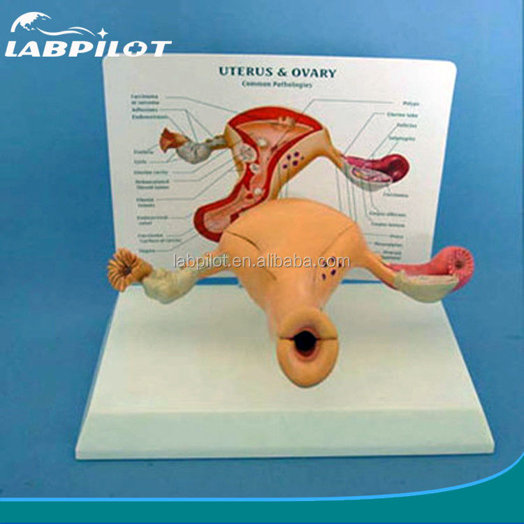 Modelo avançado do útero e do ovário humano em PVC para a educação do sistema reprodutivo feminino