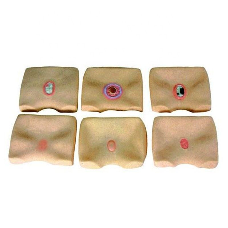 Simulador de úlceras de decúbito da pele das nádegas para hospitais Melhorar a formação em enfermagem de úlceras de cama